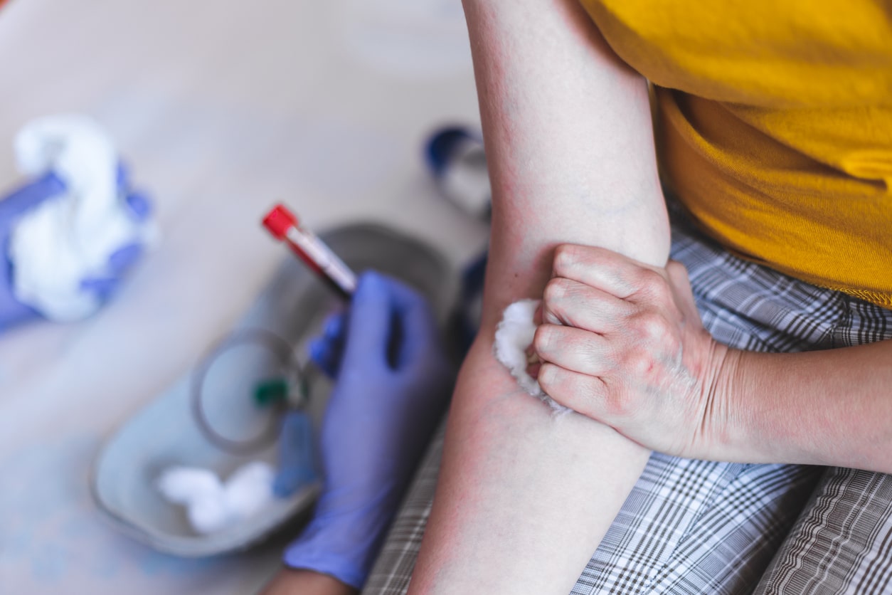 Nurse with blood test and patient in hospital – Female doctor holding small plastic vial and person’s arm with wadding – Young adult in a medical clinic for analyses