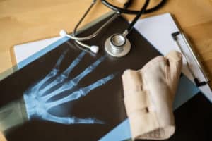 Workers’ Compensation