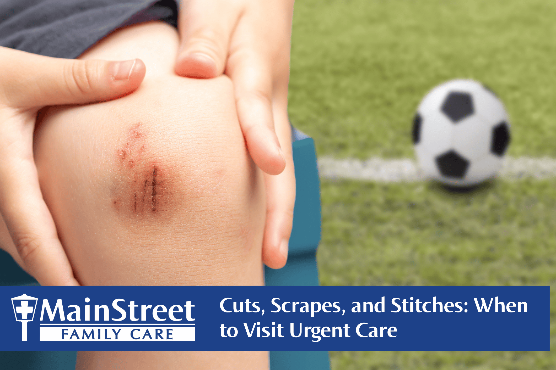 Kid with a scraped knee. Featured image for Cuts, Scrapes, and Stitches: When to Visit Urgent Care blog post