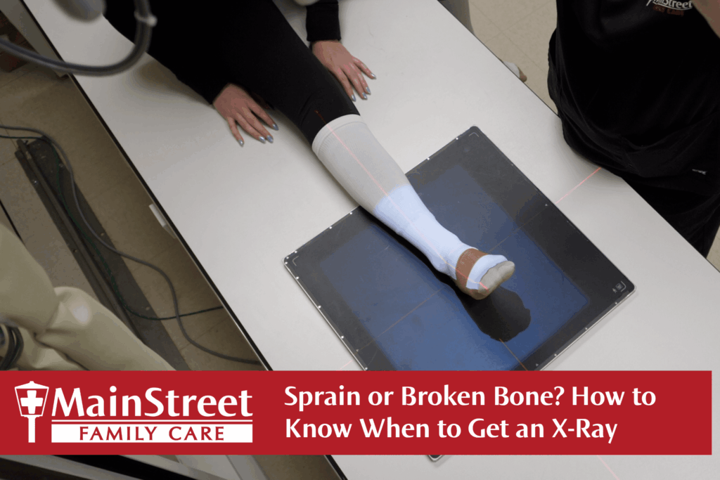 Sprain or Broken Bone? How to Know When to Get an X-Ray Sprain or Broken Bone? How to Know When to Get an X-Ray