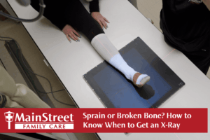 Sprain or Broken Bone? How to Know When to Get an X-Ray